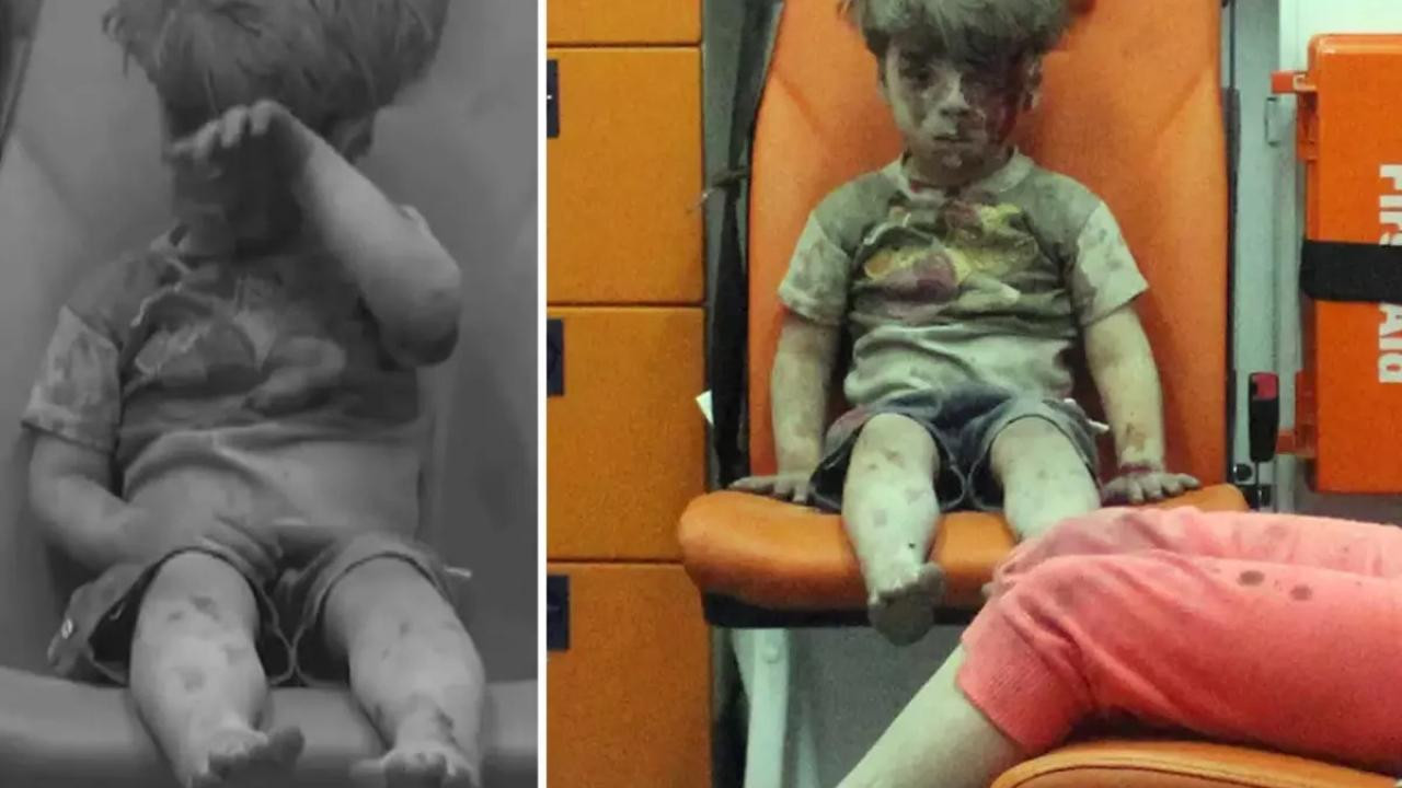 Dünya gündemine oturmuştu! Ümran bebeğin son hali ortaya çıktı!